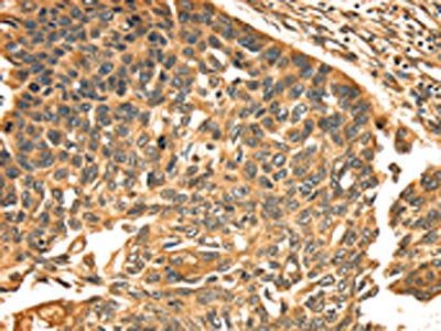 TGM1 Antibody