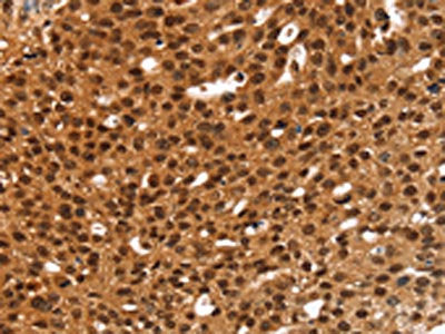 ANKRD1 Antibody