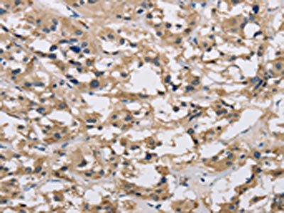 IMPDH1 Antibody