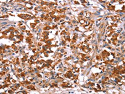 GLMN Antibody