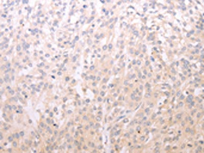 ADIPOR1 Antibody
