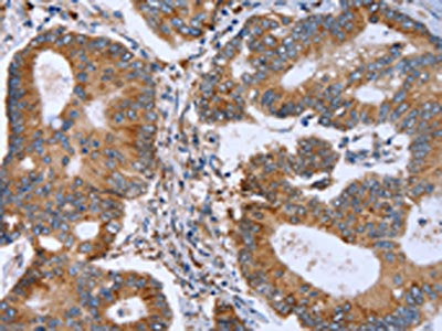 MMP9 Antibody
