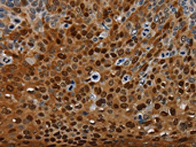 NRP2 Antibody