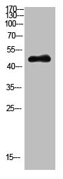 KRT14/KRT17 Antibody
