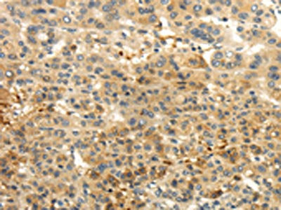CAMK1G Antibody