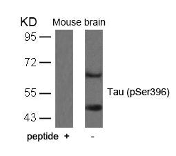 Phospho-MAPT (Ser396) Antibody