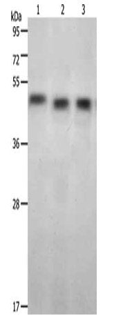 KISS1R Antibody