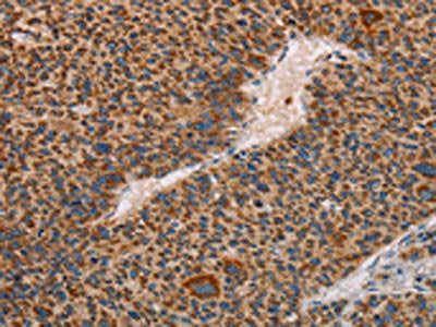 MMP1 Antibody
