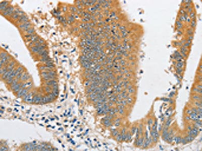 ARHGAP5 Antibody