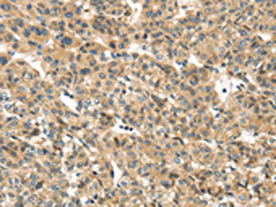 TMEM161A Antibody