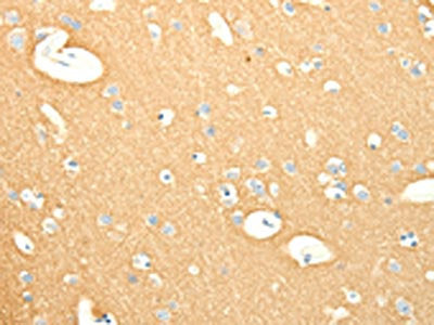 SNAP25 Antibody