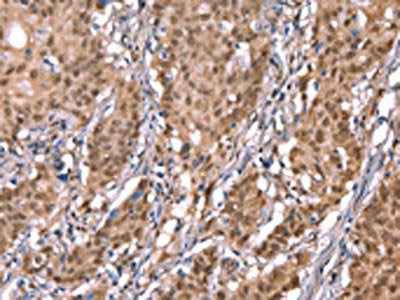 KCNJ6 Antibody