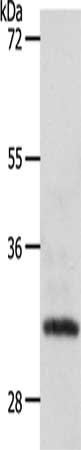 SLC2A4RG Antibody