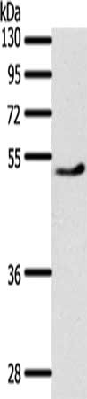 PPARD Antibody