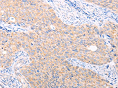 TRIM32 Antibody
