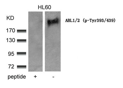 Phospho-ABL1/ABL2 (Tyr393/439) Antibody