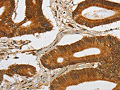 SPHK2 Antibody