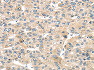 TMPRSS11B Antibody