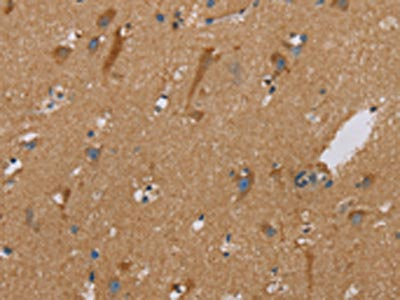 PUS10 Antibody
