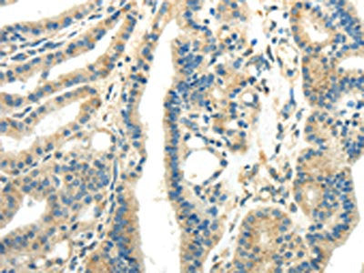 WNK1 Antibody