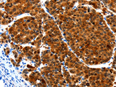 HIBADH Antibody