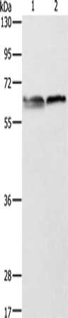 ALAS2 Antibody