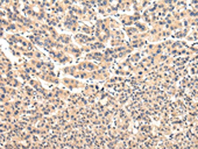 VPS37A Antibody