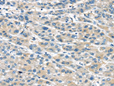TRPM2 Antibody