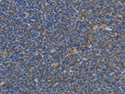 CARD6 Antibody