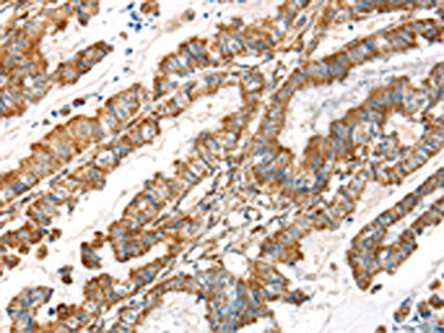 LOXL4 Antibody