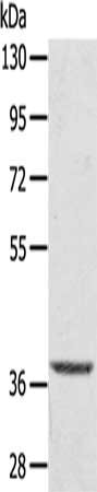 TBC1D21 Antibody