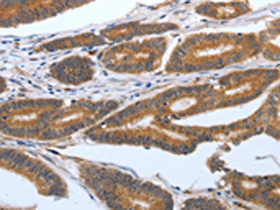 PODXL Antibody