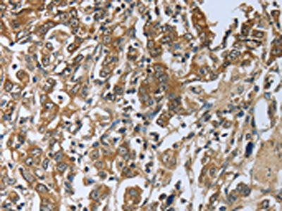 PRL Antibody
