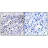 NR4A1 (Ab-351) Antibody