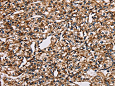 NDUFS1 Antibody