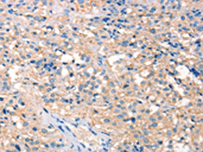 PRPS1/PRPS2/PRPS1L1 Antibody