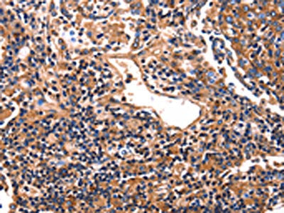 HP Antibody