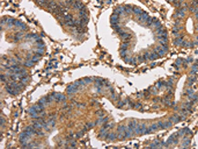 HK3 Antibody