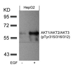 Phospho-AKT1/AKT2/AKT3 (Tyr315/316/312) Antibody