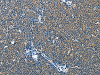 IL13RA2 Antibody