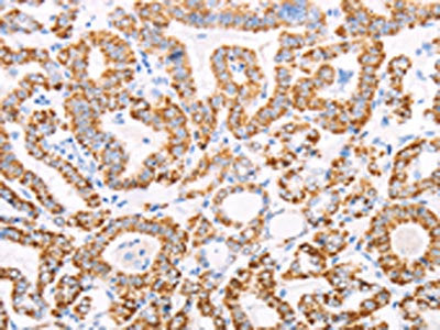 ATPIF1 Antibody