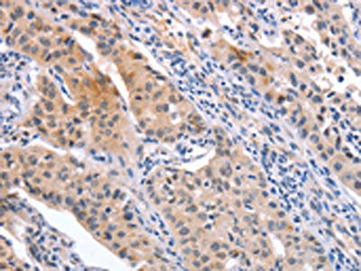 CD59 Antibody