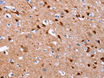 GCGR Antibody