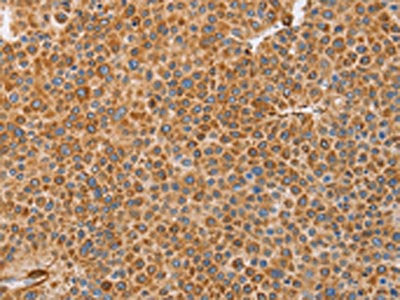 BRS3 Antibody
