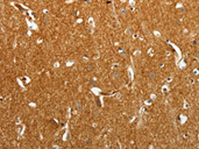 TMSB10 Antibody