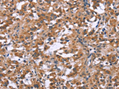 GNPAT Antibody