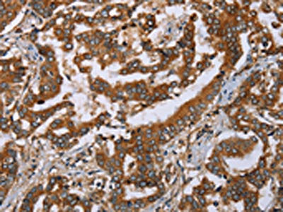 PLXNB1 Antibody