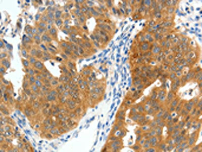 SCN9A Antibody