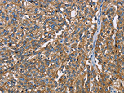 BSG Antibody
