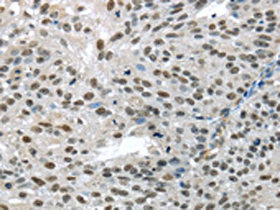 TKT Antibody